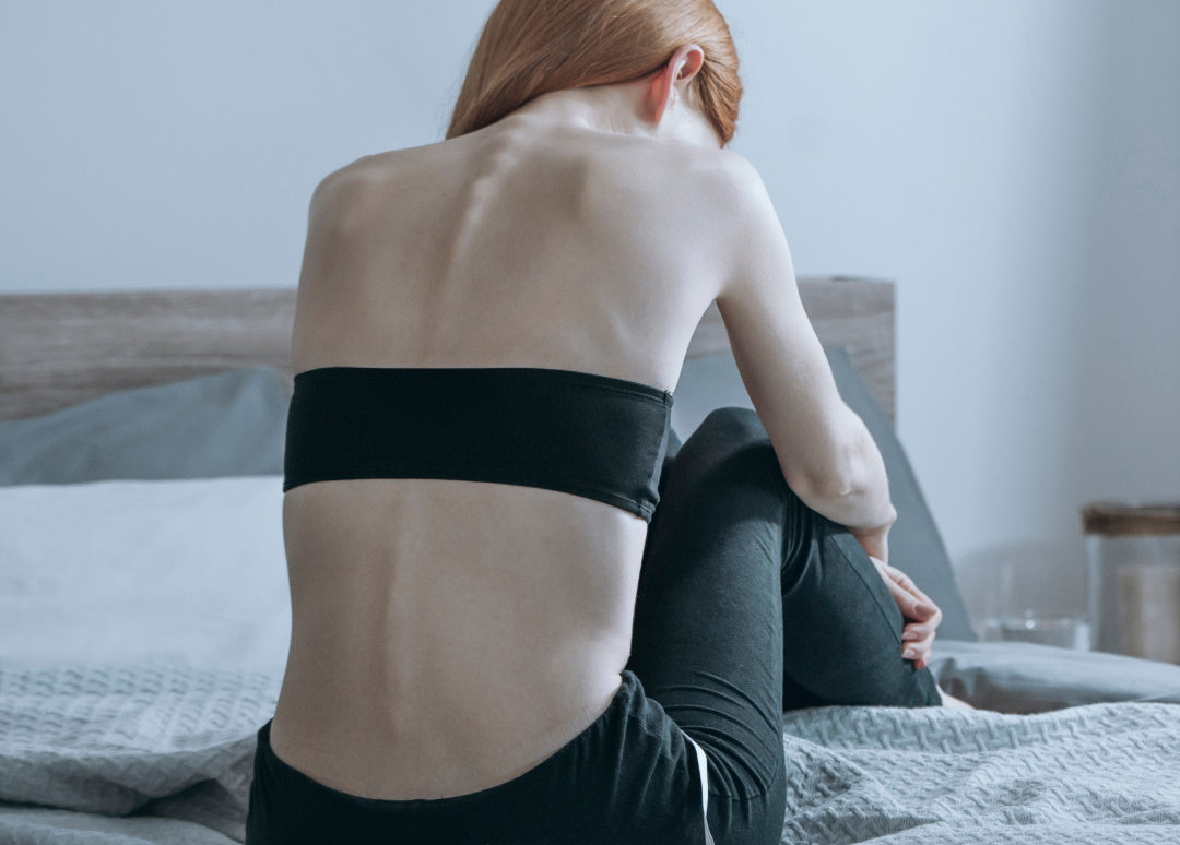 Rücken einer untergewichtigen Frau, die im BH auf dem Bett sitzt